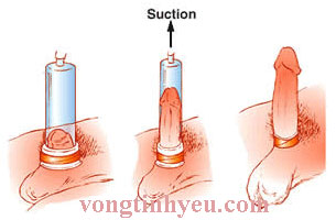 máy tập làm to kéo dài dương vật hiệu quả hàng chính hãng