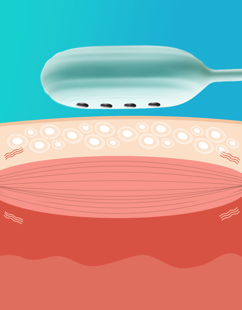 Trứng rung Svakom Viviana xung điện điều khiển qua app